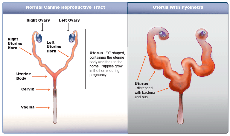 Uterine Infection